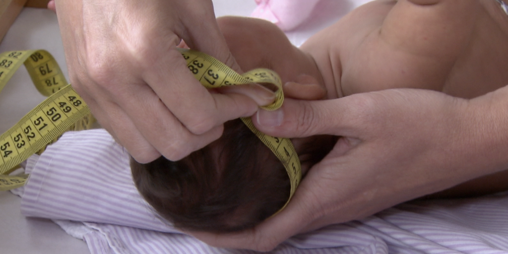 governo-regulamenta-indenizacao-e-pensao-a-vitimas-do-virus-zika