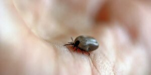 parque-no-interior-de-sp-e-interditado-apos-mortes-por-febre-maculosa