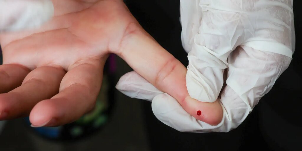 sus-passa-a-oferecer-teste-rapido-de-dengue