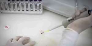 paciente-em-sp-com-suspeita-de-ebola-testa-positivo-para-meningite