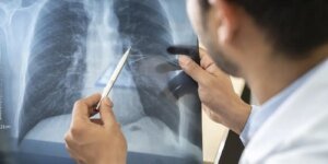 tabagismo-e-maior-entre-jovens-de-16-a-24-anos,-alerta-pesquisa
