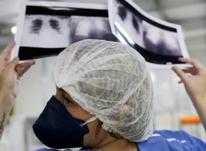 cancer-de-pulmao:-15%-dos-casos-acontecem-em-nao-fumantes