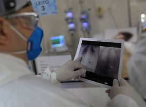 covid-e-principal-causa-de-internacao-por-sindrome-respiratoria-no-rio