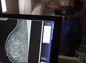 ministerio-da-saude-passa-a-recomendar-mamografia-a-partir-dos-40-anos