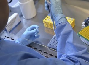 pais-tem-17-casos-confirmados-de-intoxicacao-por-metanol