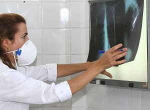 oms-recomenda-testes-de-diagnostico-rapido-para-erradicar-tuberculose