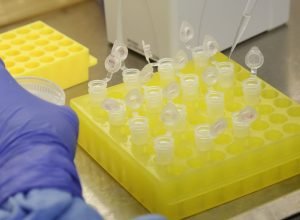 sp-confirma-segundo-caso-importado-de-sarampo